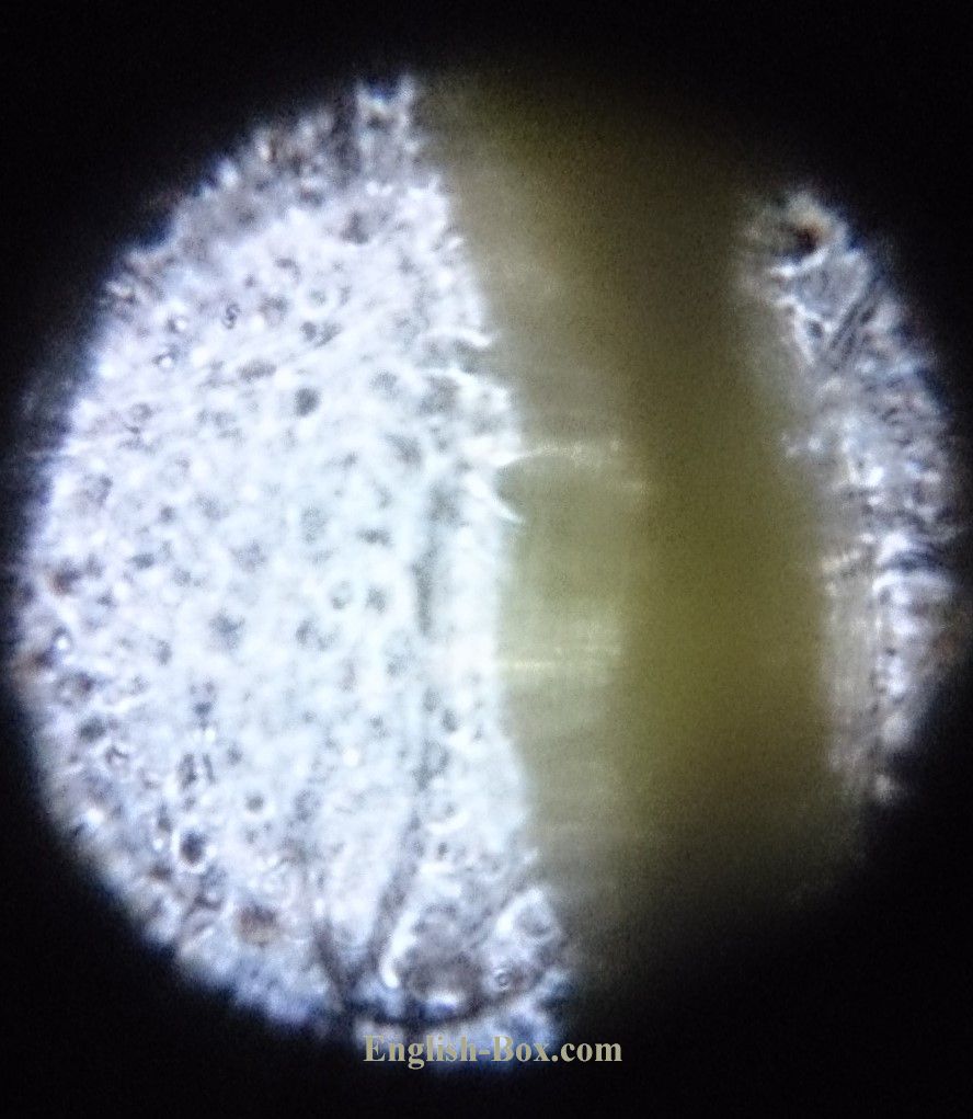 Foldscope（フォールドスコープ）での観察写真